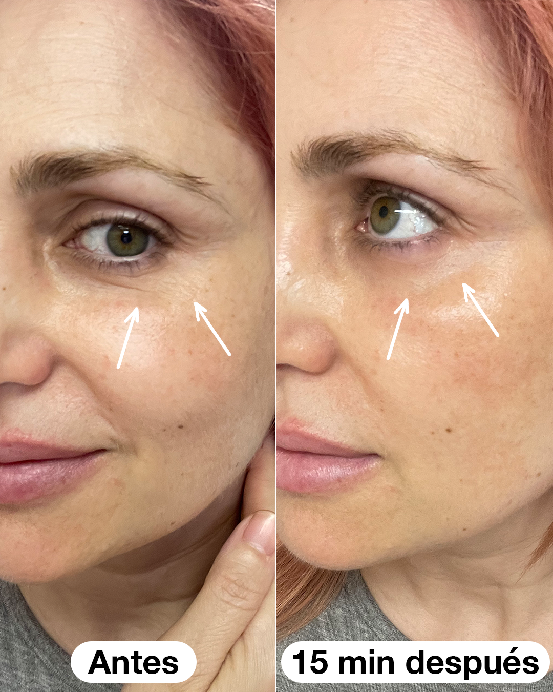 Eye Salad Code Roll-on Serum 10 ml