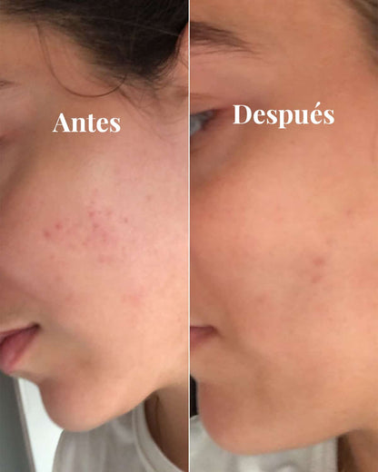 Serum mot pigmentfläckar, 30 ml