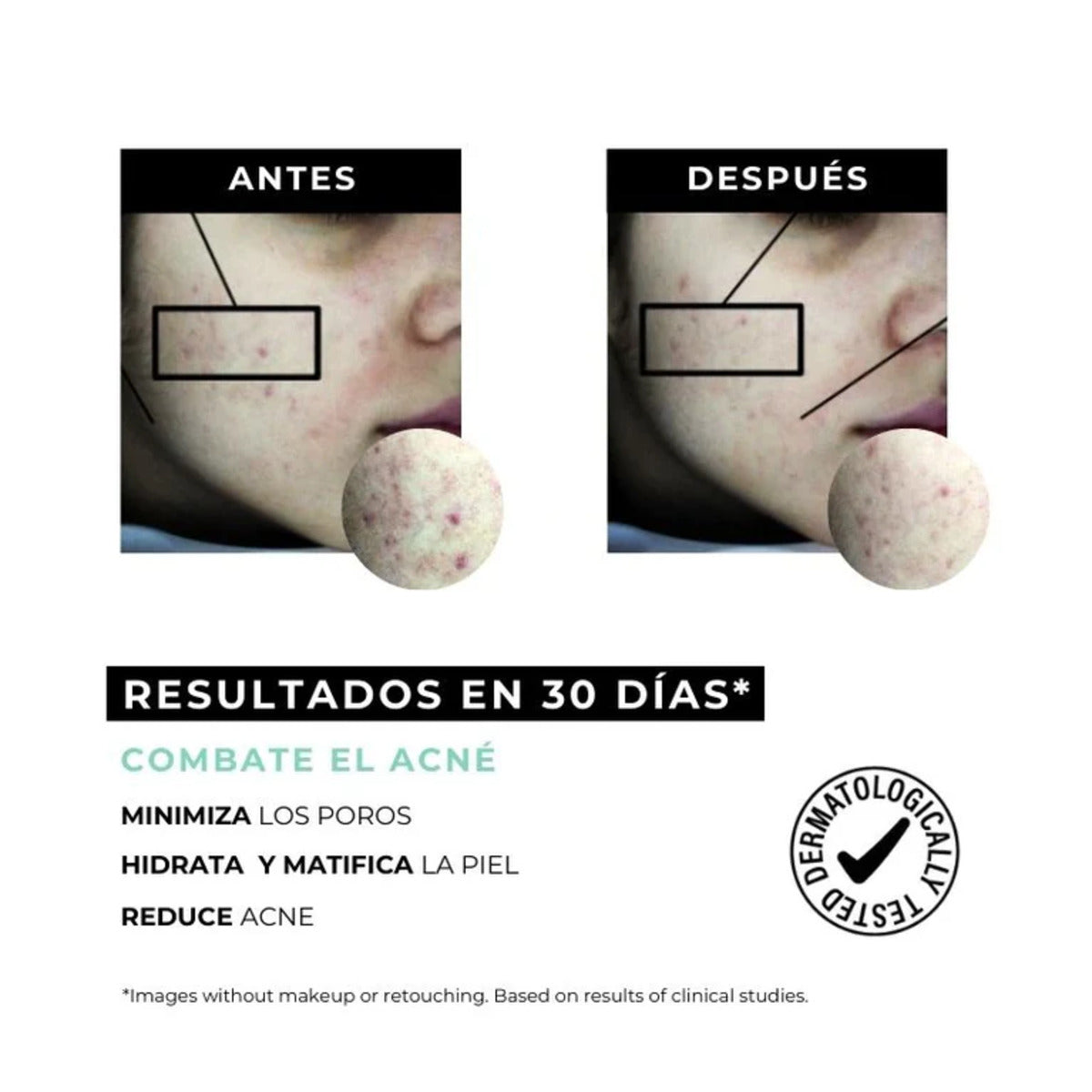 Equilibrium anti-akne kräm för fet hud Arganour 30 ml