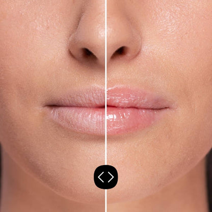 Volumateur pour les lèvres hyaluronique Freshly 5 ml